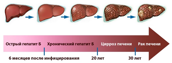 Развитие гепатита