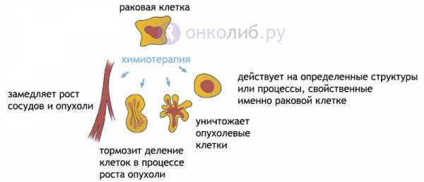 Антибиотики при химиотерапии в онкологии