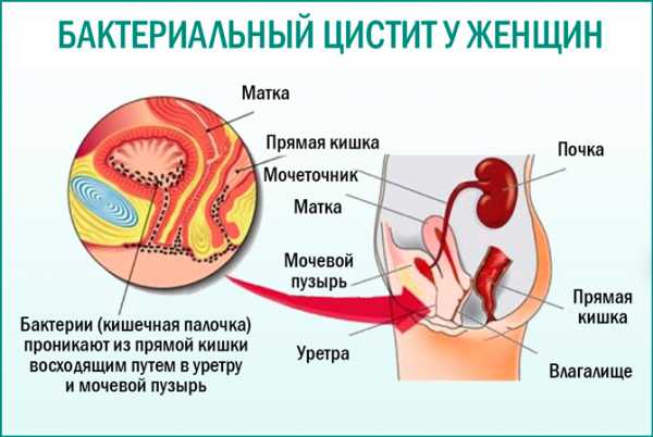 Цифорал антибиотик от цистита цена