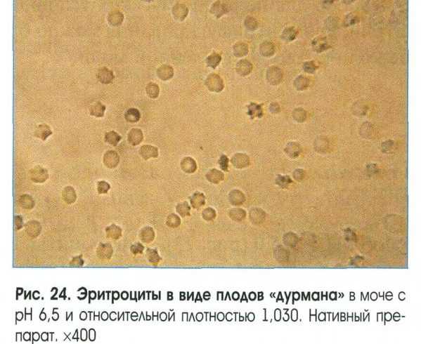 Эритроциты в моче после антибиотиков