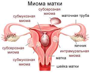 Коричневая моча после антибиотиков