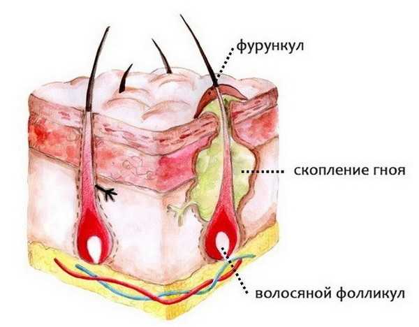 Мазь антибиотик от фурункулов