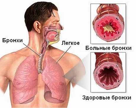 От антибиотиков черный язык