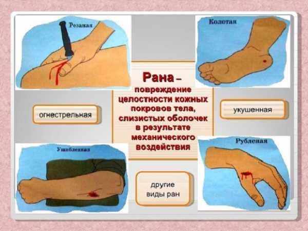 Порошок для заживления ран с антибиотиком