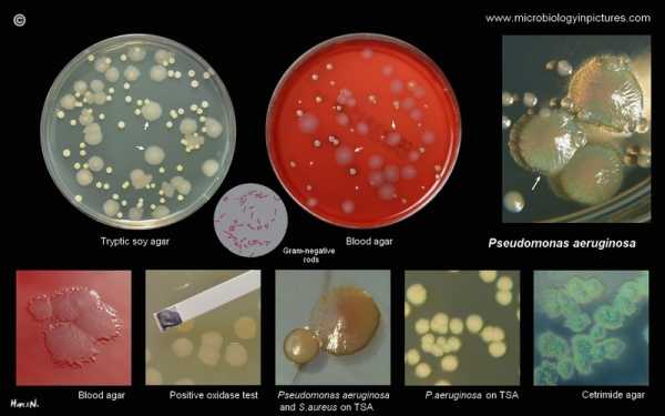 Pseudomonas aeruginosa группа a b c по антибиотикам